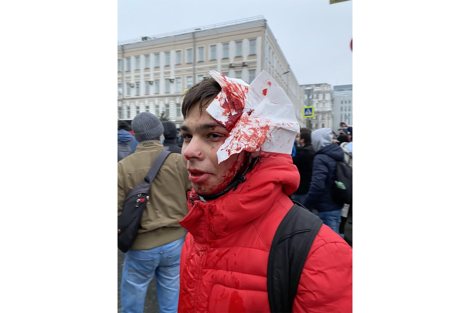 Избитый в Москве / Фото: «Протестная Россия»